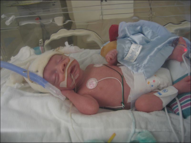 Sebastian getting a break from CPAP